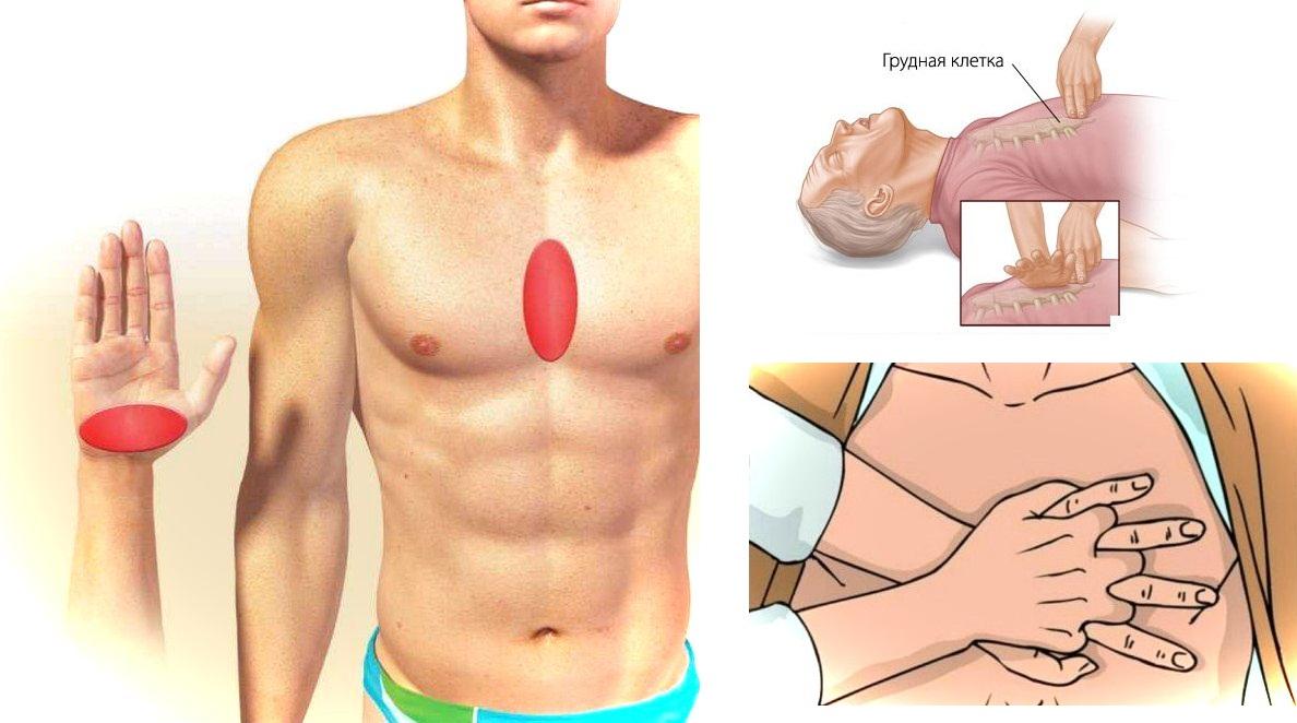 Больно нажимать. Надавил на грудную клетку. Массаж грудины. Мышцы грудной клетки для массажа. Нажатия на грудную клетку.