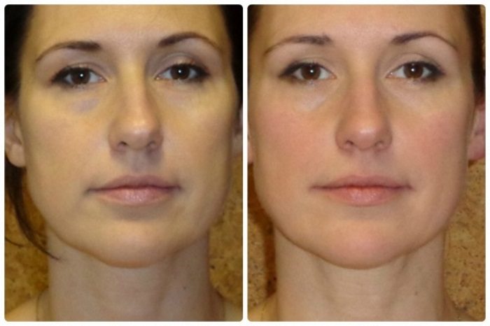 25fbef407676ed3c5b1dc60528ab7e5e