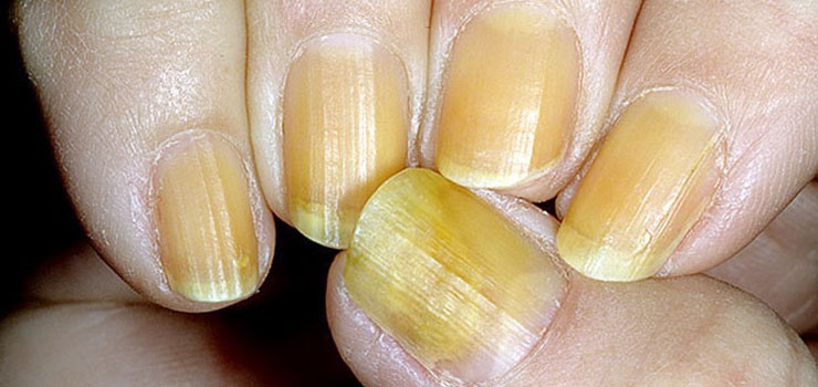 37a06e4a72d6cb27621f1ed829bbee81_l