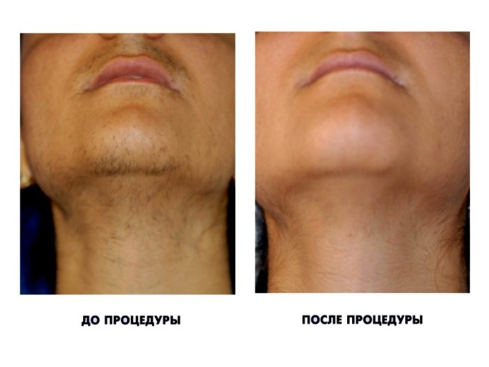 3d019e05f1ef44cbbd78a2019a879e9d