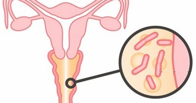 bakterialniyvaginozsimptomilechenieprepa_909cc239