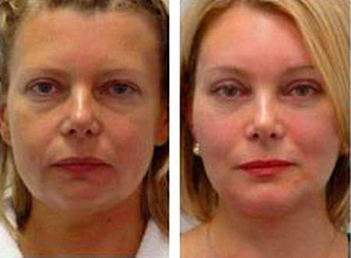 feisbilding-uprazhnen-foto1