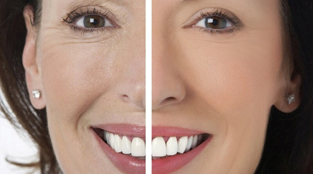 revitonika-otzyivyi-otritsatelnyie-6