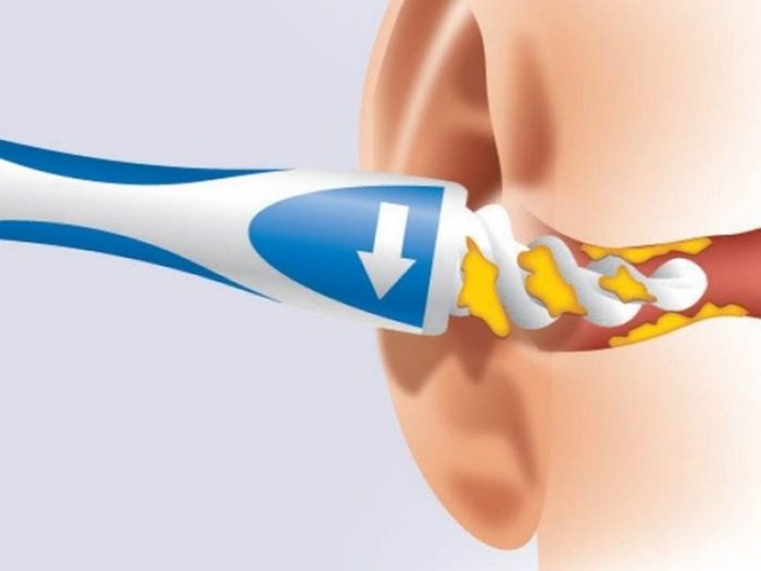 104955160-ca87dcb53dd6e695a63df1cac5f54647