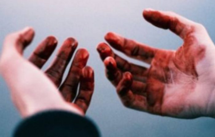 руки кровь.