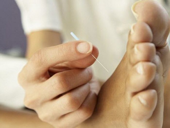 acupressure-point-for-headache