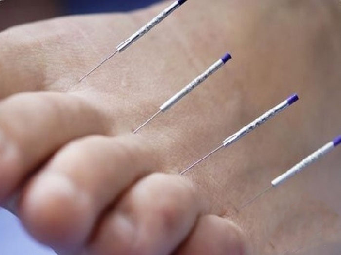 akupunkturnye-tochki-na-stope-1