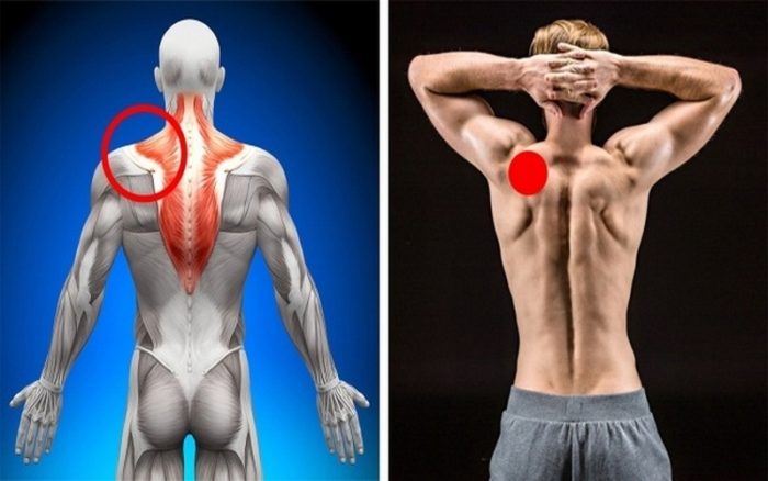 verh-trapecievidnoj-myshcy