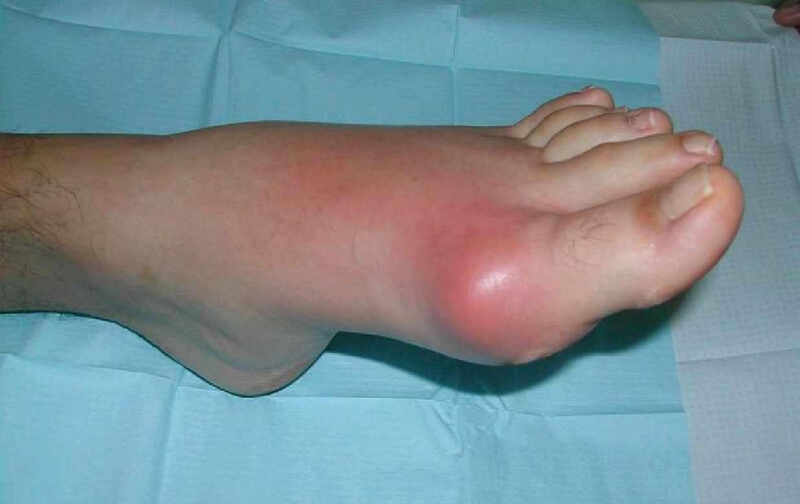 645585927516fb155df843ff482ad656