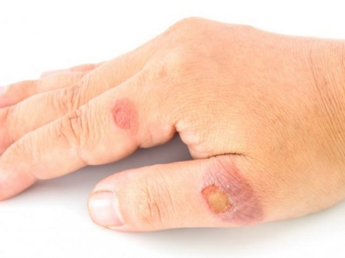 images-cms-image-000060423