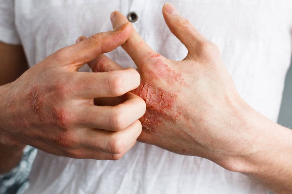 shutterstock_580580401-1024x683