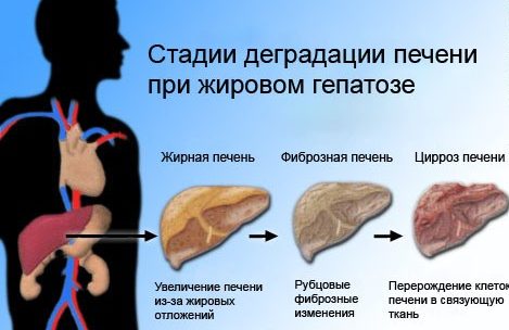 5a739fef26fd35a739fef27015