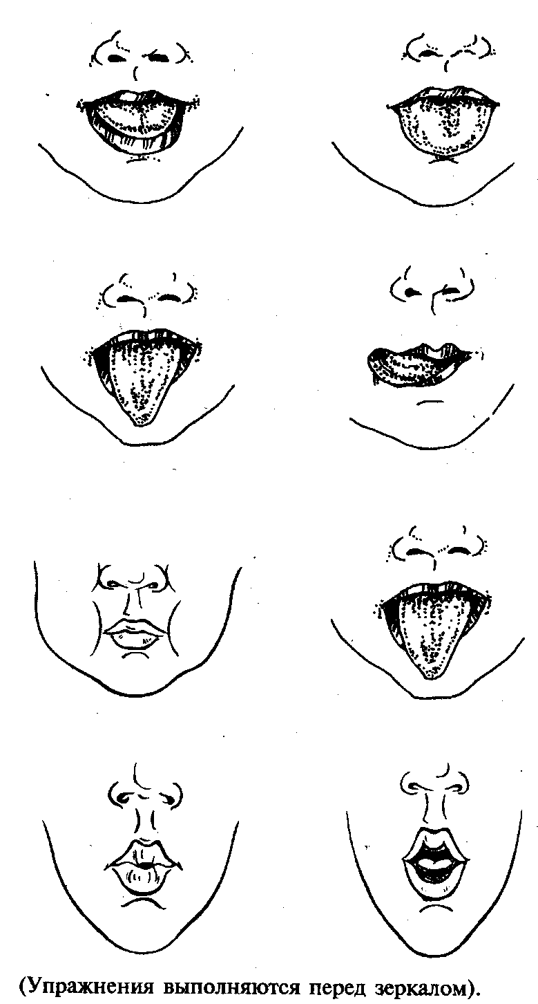 Артикуляционная гимнастика после инсульта в картинках