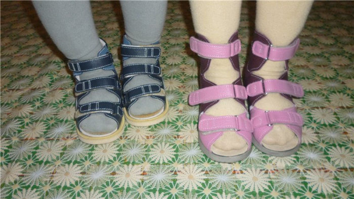Обувь при деформации стопы у детей