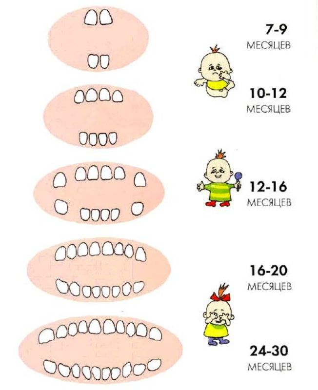 В какой последовательности лезут зубы у малышей таблица фото