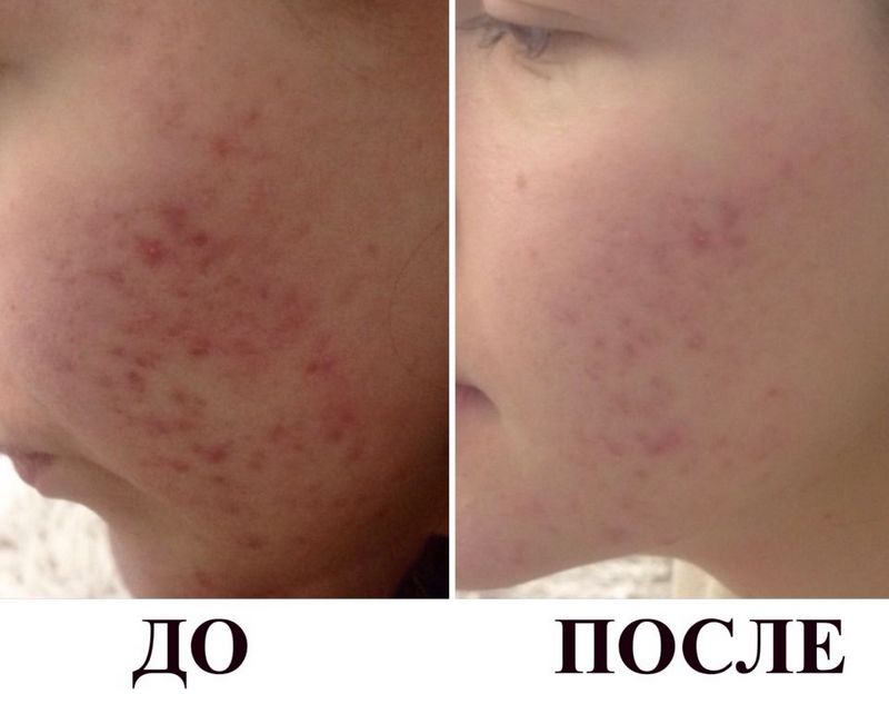 85edf7594dddd51fcbfad1e6865580ac