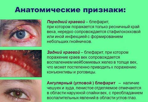 12-3045shnepldazhyei