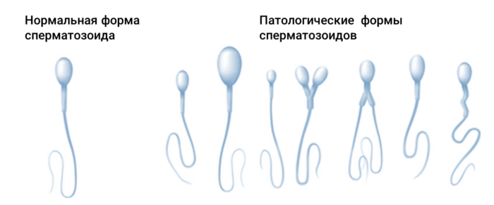 sperm_abnormal