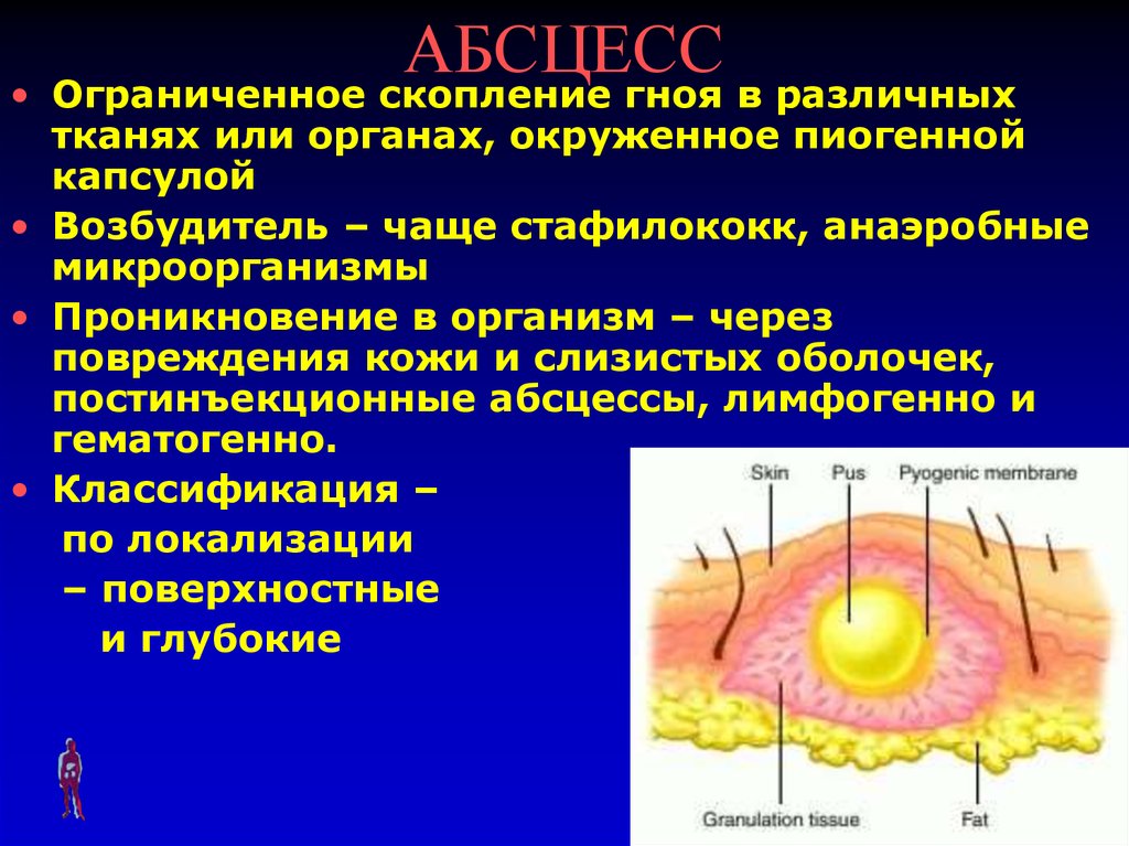 slide-19