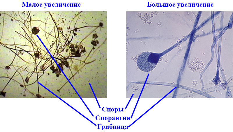 Какой микропрепарат изображен на рисунке. Строение плесневого гриба мукор. Гриб мукор строение под микроскопом. Плесневые грибы Mucor. Микропрепарат плесневого гриба мукора под микроскопом.