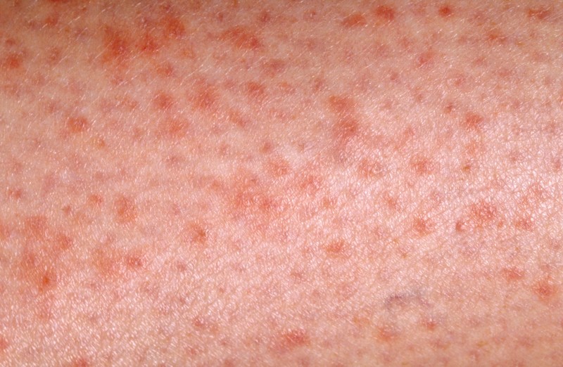 0f62aaeb7c4a776df5f66b0e73ab6da6