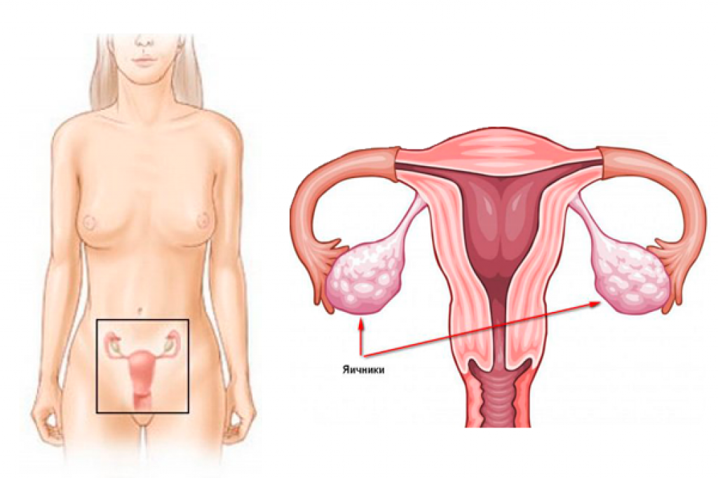 Где матка и яичники. Яичники анатомия расположение. Матка с яичниками анатомия строение. Анатомия женщины матка и яичники. Расположение яичника и маточной трубы.