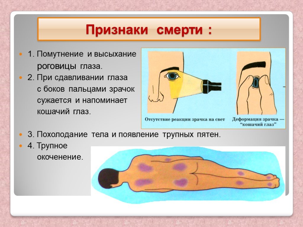 Признаки биологической смерти картинки