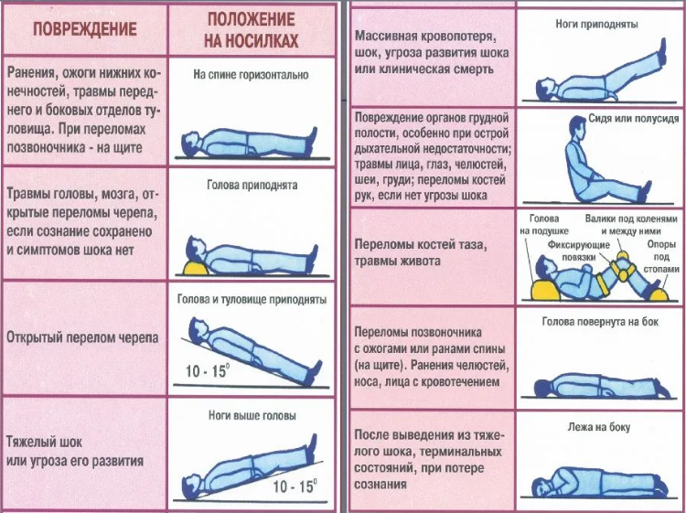 Установите соответствие между изображениями травм с их наименованиями